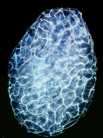 whole-finch-testicle whole-finch-testicle