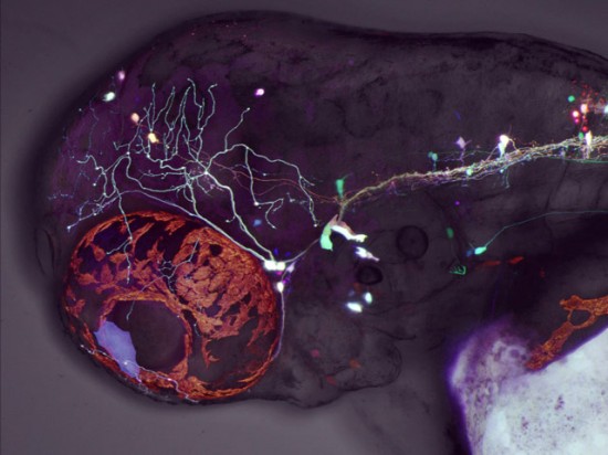 zebrafish-larvae-fluorescent-neurons zebrafish-larvae-fluorescent-neurons